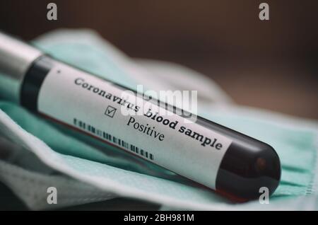 Coronavirus 2019-nCoV Blood Sample. Epidemic virus Respiratory Syndrome stock photo. Corona virus outbreak. Stock photo of  tube with Blood Test(novel Stock Photo