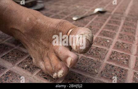 This foot with micosys, belongs to a craftsman from the streets of San Telmo, Buenos Aires Stock Photo