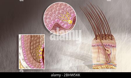 Medical illustration showing the melanocytes (in yellow) at the ...