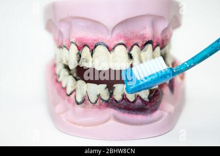 Toothbrush cleaning wooden dentures with caries and cavities on white ...