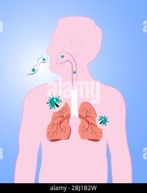 Damaged from virus cells biting lung. Coronavirus (COVID-19) with scary and evil face eating lung. 2019-nCoV concept. Stock Vector