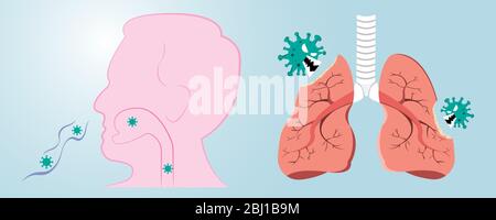 Damaged from virus cells biting lung. Coronavirus (COVID-19) with scary and evil face eating lung. 2019-nCoV concept. Stock Vector