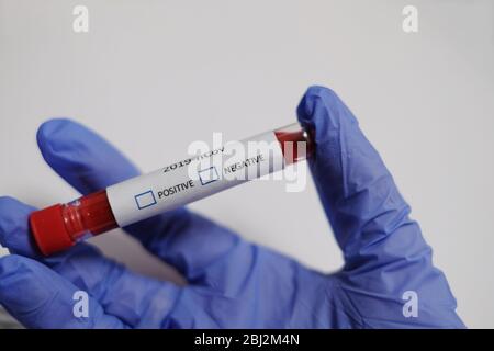 Coronavirus 2019 test concept. Close up of the test tube in hand that put medical gloves. Laboratory tests against COVID-19. Stock Photo