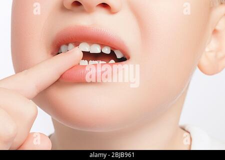 Closeup of the boy touches a crooked milk tooth and experiences pain. Tooth loss, dental problems concept Stock Photo