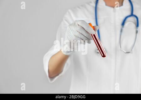 Doctor hand in glove holding test tube with blood on light background Stock Photo