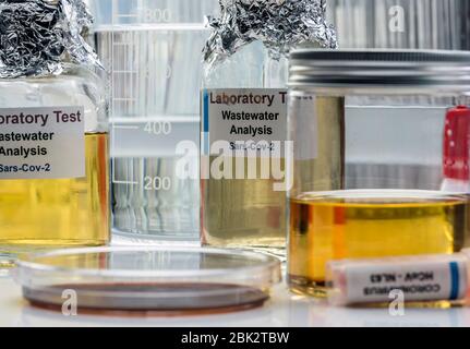 Wastewater samples, analysis of sars-cov-2 virus in patients infected by human coronavirus 229E, conceptual image Stock Photo