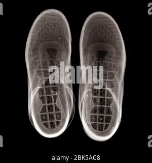 Trainers from above, X-ray. Stock Photo
