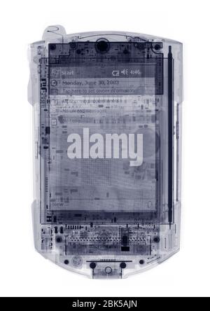 PDA, X-ray. Stock Photo