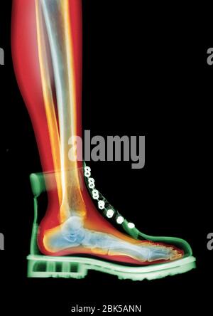 Lace-up boot, coloured MRI style X-ray. Stock Photo