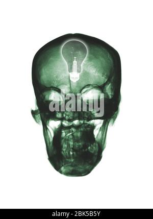 Human skull and light bulb, X-ray. Stock Photo