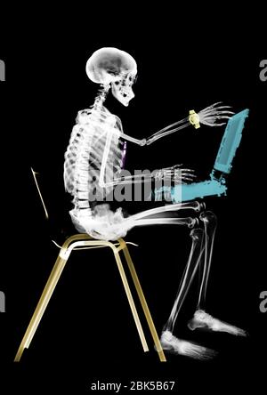 Human skeleton sitting with laptop computer, coloured X-ray. Stock Photo