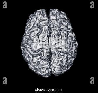Brain from above, X-ray. Stock Photo