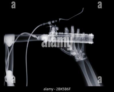 Human hand pressing brake on bicycle, X-ray. Stock Photo