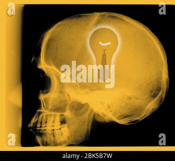 Human skull with light bulb, coloured X-ray. Stock Photo