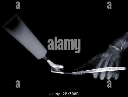 Hand holding toothpaste and toothbrush, X-ray. Stock Photo
