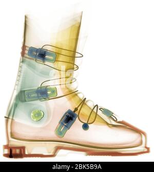 Ski boot, coloured X-ray. Stock Photo