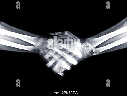 Handshake, X-ray. Stock Photo