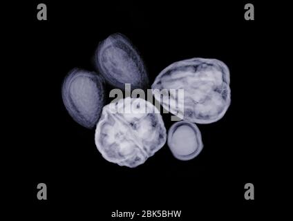 Assorted nuts, X-ray. Stock Photo