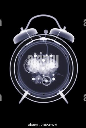 Alarm clock, X-ray. Stock Photo