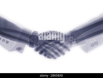 Two executive shaking hands, X-ray. Stock Photo