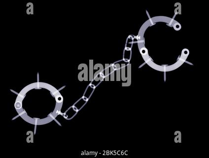Spiked handcuffs, X-ray. Stock Photo