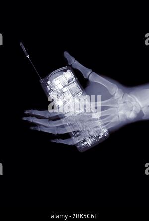 Hand holding a mobile phone, X-ray. Stock Photo