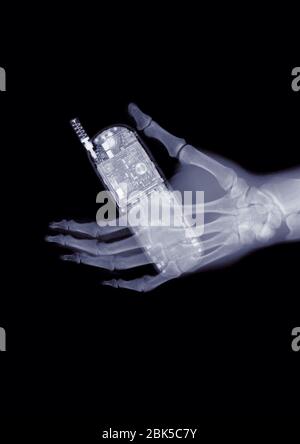 Hand holding a mobile phone, X-ray. Stock Photo