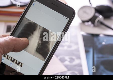 Person's hand checking x ray on smartphone Stock Photo