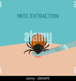 How to remove mite insect parasitic. Encephalitis Tick Warning Sign. Stock Vector