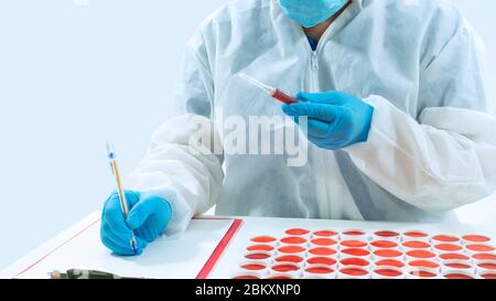 Close up to doctor with blue gloves writing on a white sheet of paper, holding a syringe with blood in his hand, sitting next to a group of clinical s Stock Photo