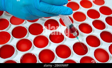 Close up of a man's hand with blue glove holding a jargon taking a sample of red liquid from a set of clinical samples in round containers on a white Stock Photo