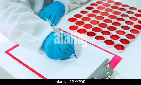 Close up to doctor with blue gloves writing on a white sheet of paper sitting next to a group of clinical samples of red liquid in round white contain Stock Photo
