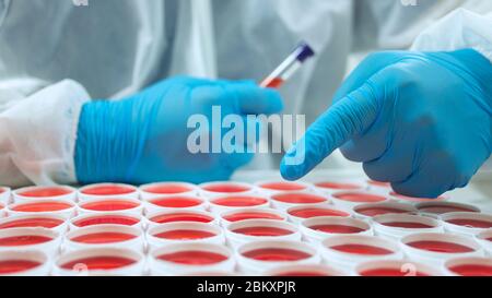 Close up view of doctor in blue glove pointing his finger at a group of round red clinical specimens on a white surface. With his other hand he holds Stock Photo