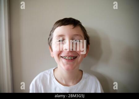 Tween Boy With Red and Green Braces Grins At Camera, Close Up Stock Photo
