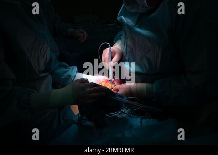 a surgical team performs a surgical abdominal operation Stock Photo