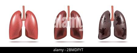 Normal lung and lung cancer illustration. Vector. Stock Vector