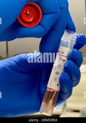 Santa Barbara, California, USA. 8th May, 2020. A doctor wearing blue gloves holds a Covid 19 Antibody Nasal Swab test and prepares to send it to the lab. Credit: Amy Katz/ZUMA Wire/Alamy Live News Stock Photo