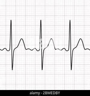 Cardiogram. Electrocardiogram. Graphic representation of heart work . Health and medicine. Stock Vector