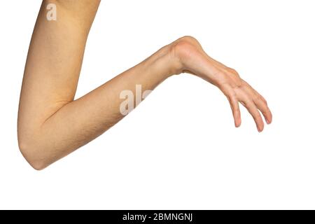 hyperlaxity of the wrist and hand, Marfan, Elher danlos. Stock Photo