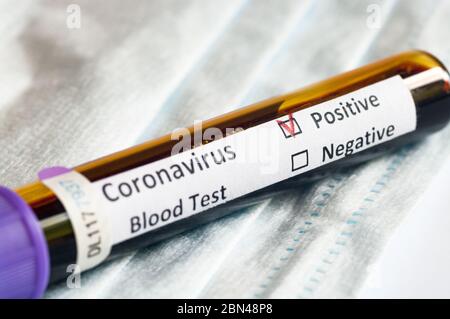 Blood sample tube positive with COVID-19 or novel coronavirus SARS-CoV-2. Stock Photo