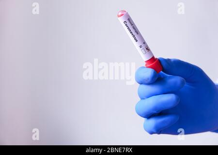 laboratory technician hand holding blood test tube  Stock Photo