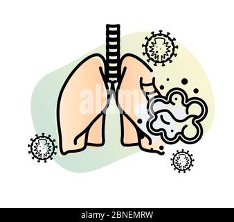 Covid-19 Impact on Human Lungs - PULMONARY EDEMA - Illustration as EPS 10 File Stock Vector