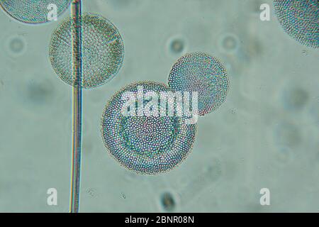 Diatomaceae, Antarctic marine diatoms photographed through microscope Stock Photo