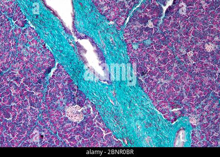 Human Histology, section of pancreas, light photomicrograph Stock Photo