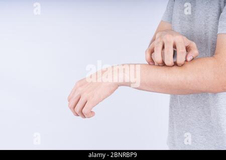 Male scratching his arm on white background with copy space. Medical, healthcare for advertising concept.