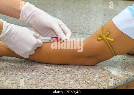 Blood test from venous vein  of patient by female doctor in white medical gloves on   the marble table Stock Photo