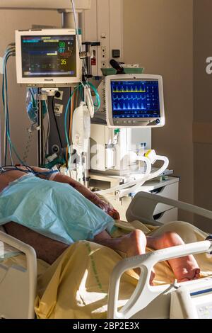 Patient with Covid 19 in decubitus, supported in an intensive care unit, Paris. Stock Photo