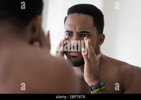 Anxious african american man worried about face wrinkles Stock Photo