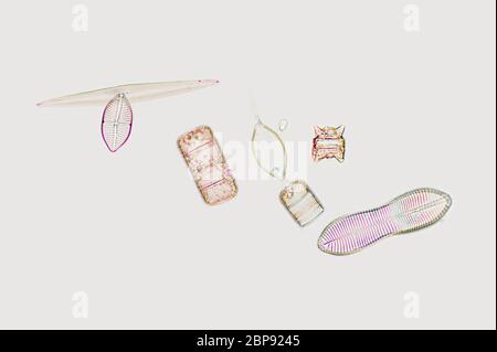 Diatoms, microscope view Stock Photo