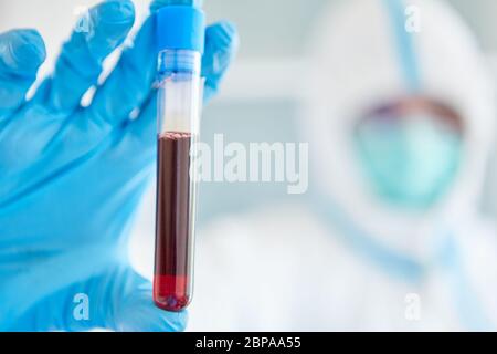 Scientist in the laboratory stops taking blood during the Coronavirus and Covid 19 pandemic Stock Photo